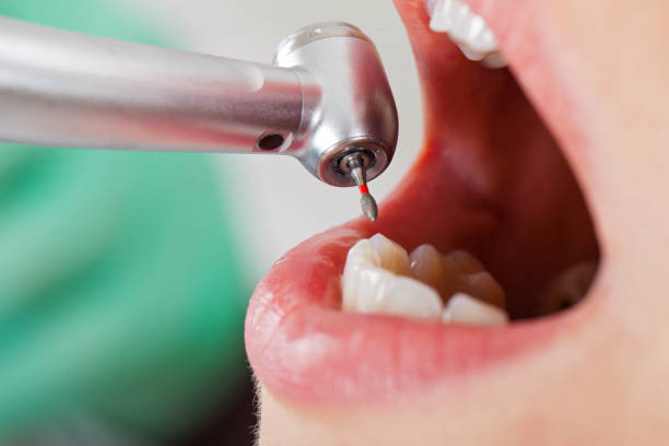 Best Emergency Treatment for Oral Infections in Mcfarland, WI